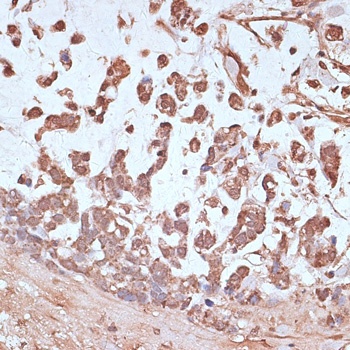 TXN Antibody