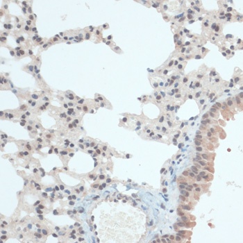 TXN Antibody