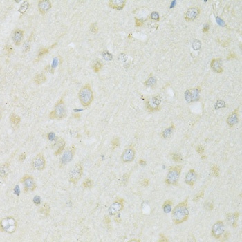 SLC22A5 Antibody