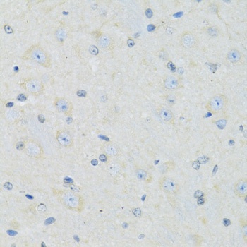 SLC22A5 Antibody
