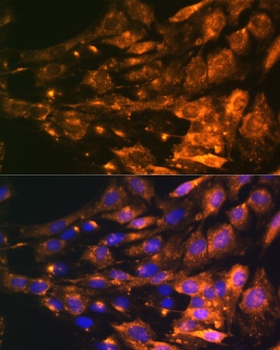 PTCH1 Antibody