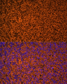 PTCH1 Antibody