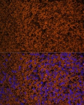 PTCH1 Antibody