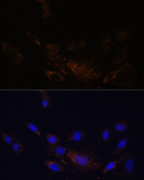 PSMB7 Antibody