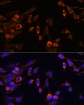 PSMB7 Antibody