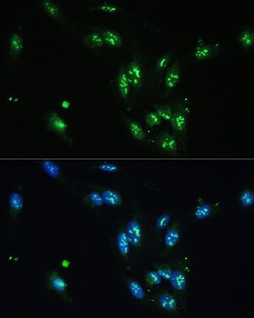 NFE2L1 Antibody