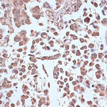 NFE2L1 Antibody