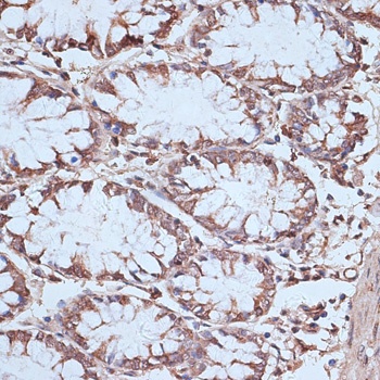 NFE2L1 Antibody