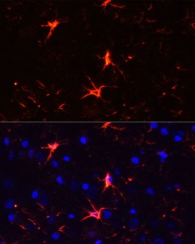 NFE2L1 Antibody