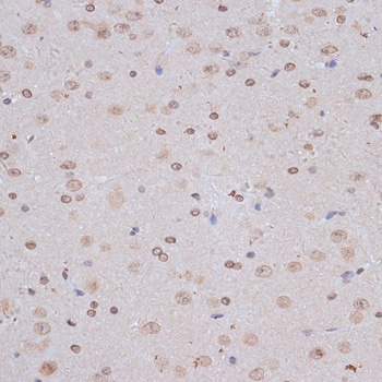 NFE2L1 Antibody