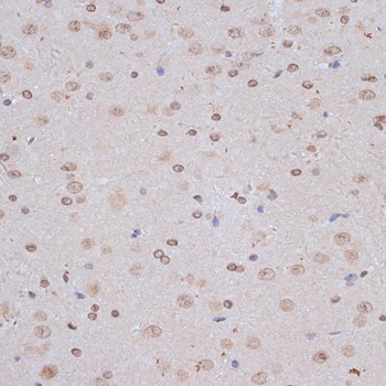 NFE2L1 Antibody