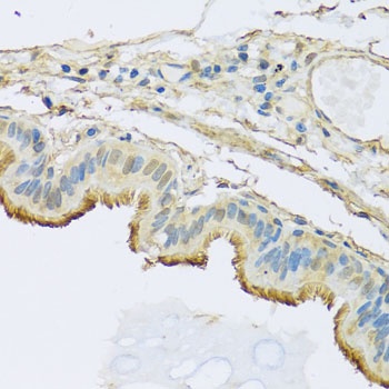NDUFB5 Antibody