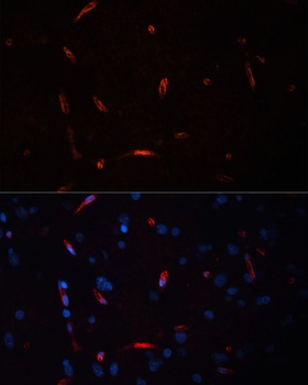 HCRTR1 Antibody