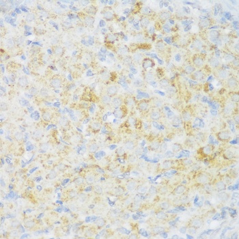 CACNB3 Antibody