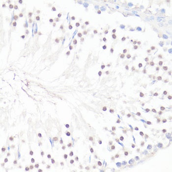 GLI1 Antibody