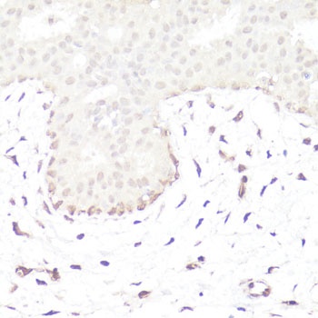 GLI1 Antibody