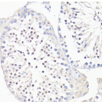 GLI1 Antibody