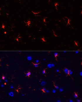 GFAP Antibody