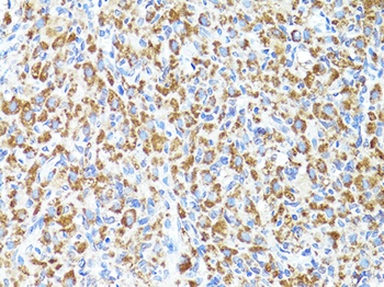 S100A10 Antibody