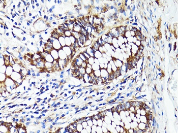 S100A10 Antibody