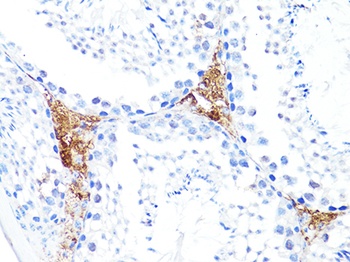 S100A10 Antibody