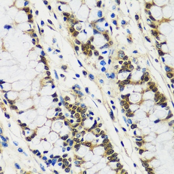 S100A10 Antibody