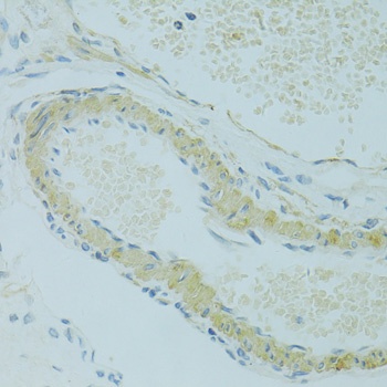 IFT57 Antibody