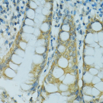 CYP2B6 Antibody