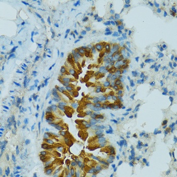 CYP2B6 Antibody