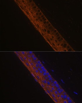 MYH13 Antibody