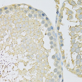 SLC2A9 Antibody