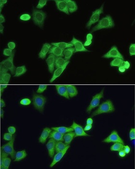 SLC2A9 Antibody