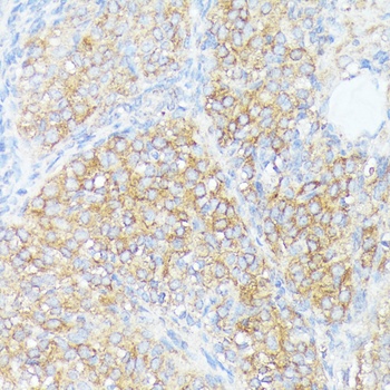 SLC7A2 Antibody