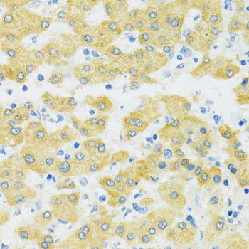 SLC37A4 Antibody