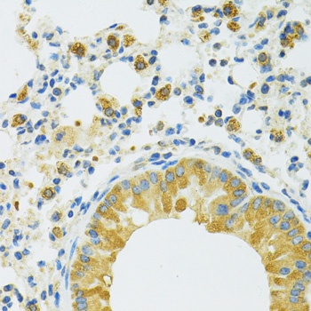 SLC37A4 Antibody