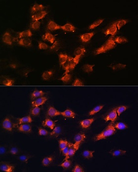 DPP4 Antibody