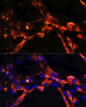 DPP4 Antibody