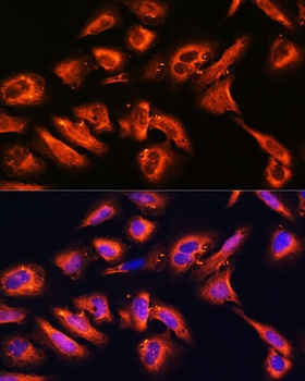 DPP4 Antibody