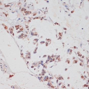 HTATSF1 Antibody