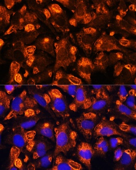 FGA Antibody