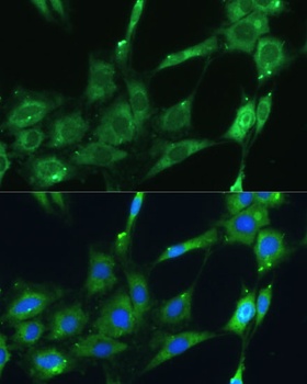 SPARC Antibody