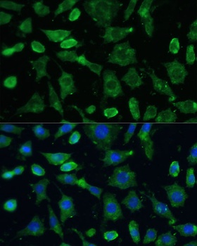 SPARC Antibody