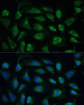 SPARC Antibody
