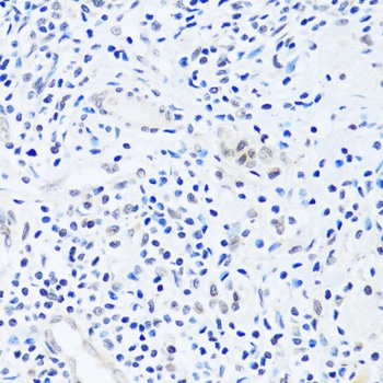 BRIX1 Antibody