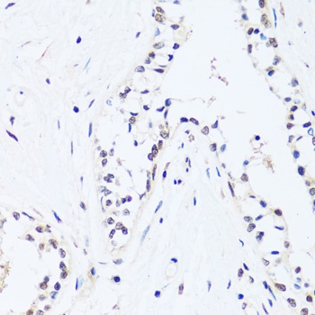 BRIX1 Antibody