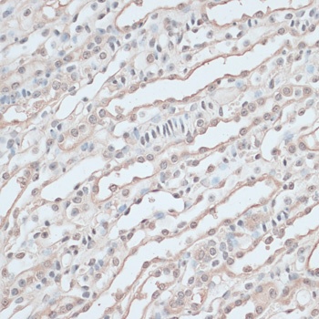 ZNF597 Antibody