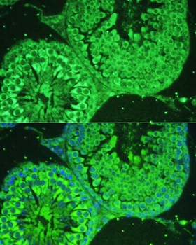 ASZ1 Antibody