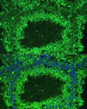 ASZ1 Antibody