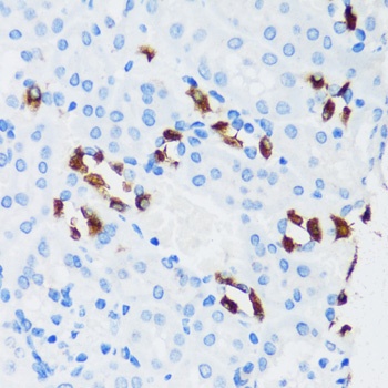 ATP6V1G3 Antibody