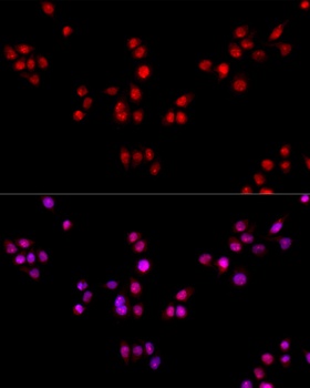 CCDC59 Antibody